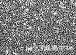 ICR 小鼠胚胎成纤维细胞(灭活)（MEF）