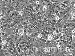 人输尿管上皮永生化细胞(SV-HUC-1)