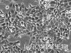 人肺癌细胞(NCI-H2126)
