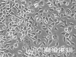 人子宫颈表皮癌细胞（ME-180）