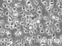 人套细胞淋巴瘤细胞(Jeko-1)