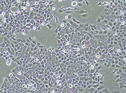 人结肠癌细胞（HCT116）
