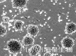 人非霍奇金淋巴自然杀伤细胞(NK-92MI)