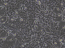 小鼠肝癌细胞（Hepa1-6）