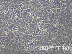 SiHa细胞human NAT10基因敲除株(CGKO-M2134)