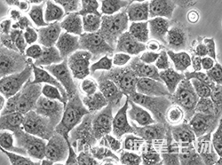 人子宫内膜癌细胞(Ishikawa )