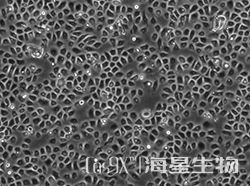 人支气管上皮细胞（HBE135-E6E7）