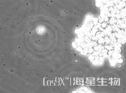 人小细胞肺癌细胞(NCI-H69)