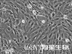 人脑星形胶质细胞(SVG p12)