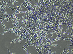 小鼠乳腺癌细胞（4T1）