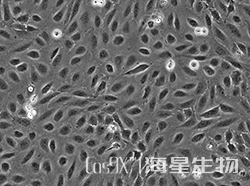 U2OS细胞Human ZBTB40基因敲除株(CGKO-M2164)