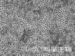 小鼠淋巴瘤细胞(L5178Y TK+/- CLONE(3.7.2C)