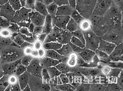 人胆管上皮癌细胞(HuCCT1)