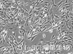 人小细胞肺癌细胞（NCI-H446）