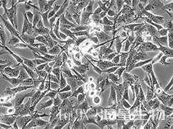 人膀胱移行细胞癌（UM-UC-3）