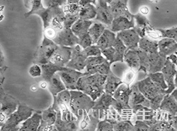 人卵巢腺癌细胞(Caov-3)