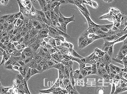 人肾细胞腺癌细胞(ACHN)