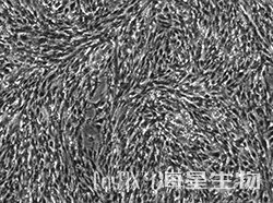 小鼠脑微血管内皮细胞(Bend.3)