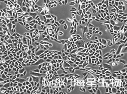 人低分化肺腺癌细胞(SK-LU-1)