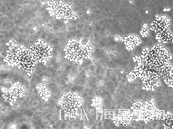 人小细胞肺癌细胞(NCI-H524)