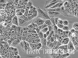 人大细胞肺癌细胞(NCI-H460)