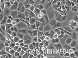 人肾上腺皮质小细胞癌细胞（SW-13）