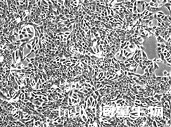 人乳腺上皮细胞系(MCF-10A)