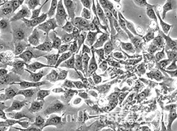 人肺腺癌细胞(NCI-H2009)