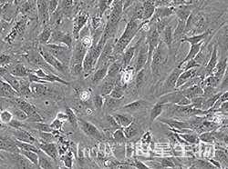 人骨肉瘤细胞（SJSA-1）