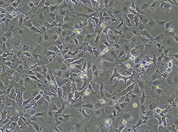 人肝癌细胞（Hep3B2.1-7）
