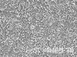 人胚肾细胞(2V6.11)