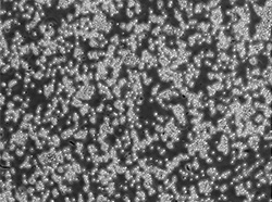 人大细胞淋巴瘤细胞(SU-DHL-6)