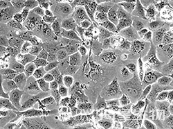 人非小细胞肺癌细胞(NCI-H23)