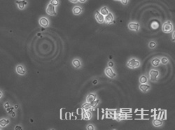 人大细胞淋巴瘤细胞(SU-DHL-10)