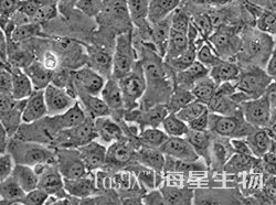 人胆管细胞型肝癌细胞(HCCC-9810)