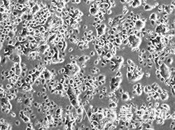 人肺癌细胞（NCI-H1437）
