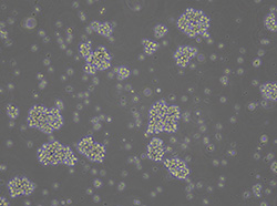 人T淋巴细胞白血病细胞Jurkat-Cas9(TCH-C225-M01)