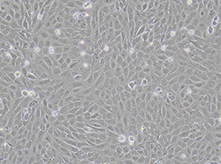 人骨肉瘤细胞（U2OS）