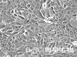 人乳腺上皮细胞系(MCF-10A)