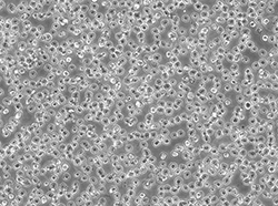 人髓性单核细胞白血病细胞（Mv-4-11）