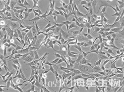 人绒毛膜滋养层细胞(HTR-8/Svneo)
