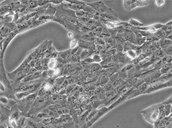 人肺癌腺癌细胞(HCC2935)