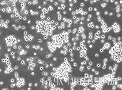 人单核细胞白血病（THP-1）