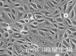 人肝癌细胞(SNU-182)