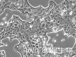 人肺腺癌细胞(胸水)(CALU-3)