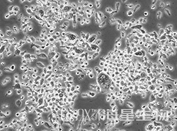 人多发性骨髓瘤克隆细胞（KMS-11）