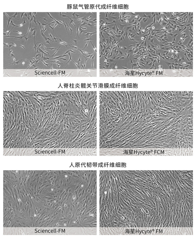 成纤维细胞形态一览.jpg