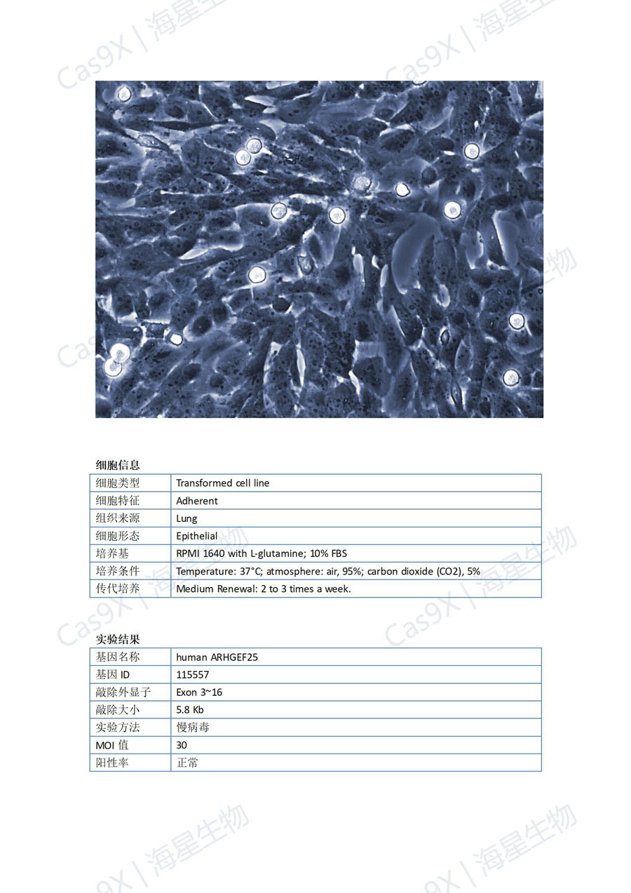 人正常肺上皮细胞（BEAS-2B ）ARHGEF25_01.jpg