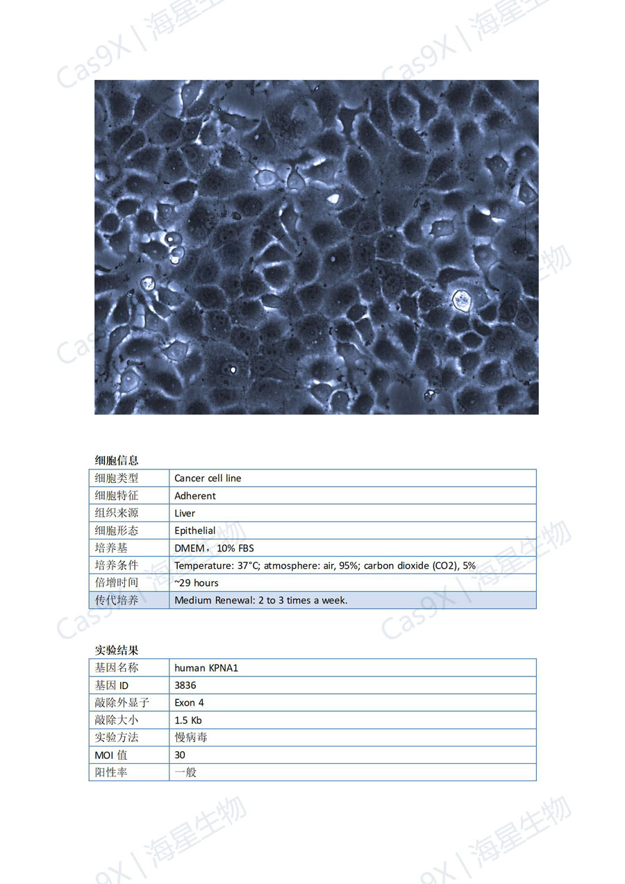 人肝癌细胞(Huh7 )KPNA1_01.jpg