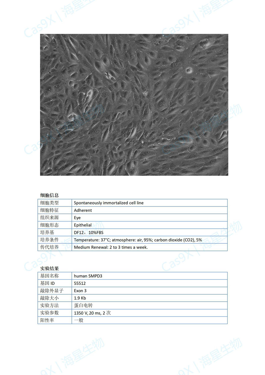 人视网膜上皮细胞(ARPE-19 )SMPD3.jpg